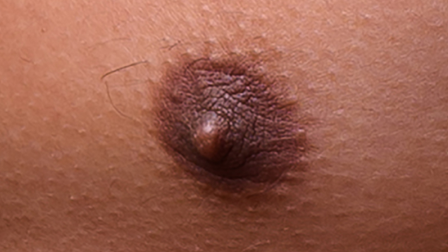 Illustration for article titled An Enemy In Hiding: Amongst These Innocent
MaleĀ NipplesĀ Lurks A Wicked FemaleĀ Nipple!